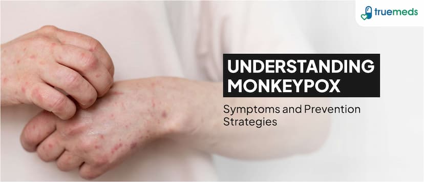 Understanding Monkeypox: Symptoms and Prevention Strategies