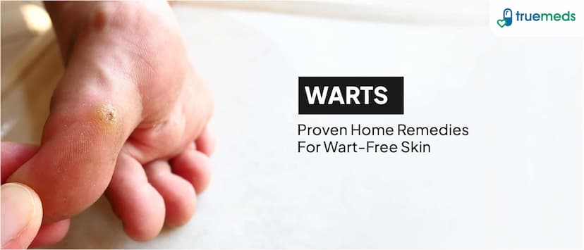 16 Natural Home Remedies for Warts