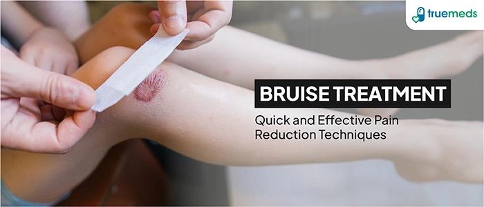 First Aid For Bruises Treatment: How To Minimise Pain And Swelling Quickly